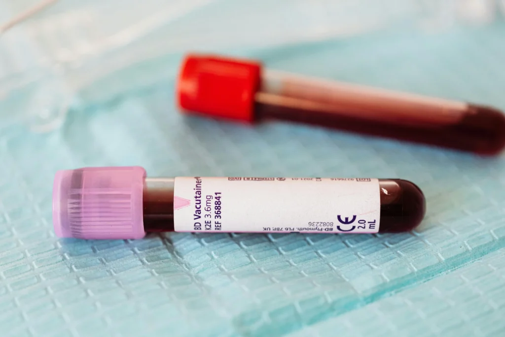 Two blood-containing collection containers; the lavender-top blood container in the front and a red-top container in the background